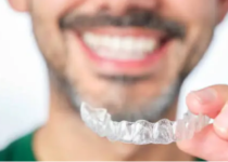 Invisalign Adelaide