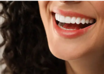 wisdom teeth removal Adelaide